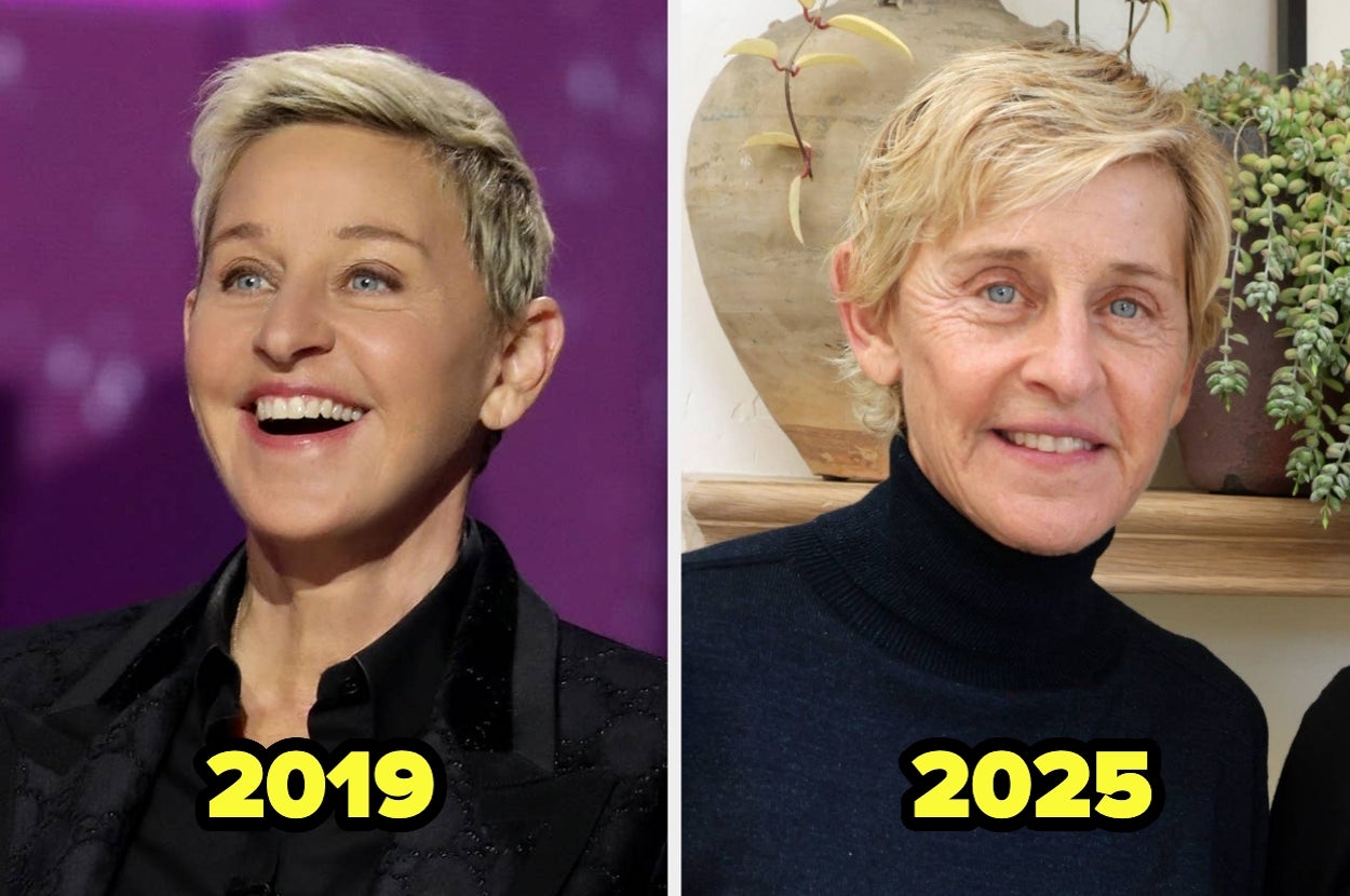 25 Celebs Who Got Rid Of Their Facial Fillers (And Why)