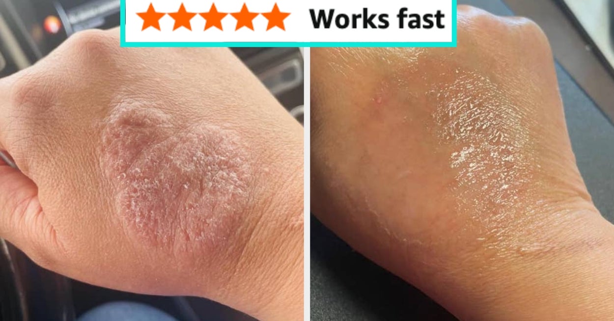 34 Beauty Items With Such Jaw-Dropping Results, You’ll Be Fully Convinced A Witch Invented Them