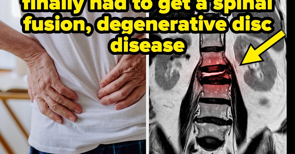 22 Patients With Chronic Conditions Are Sharing The Symptoms They Assumed Were Totally "Normal" Before They Got A Diagnosis