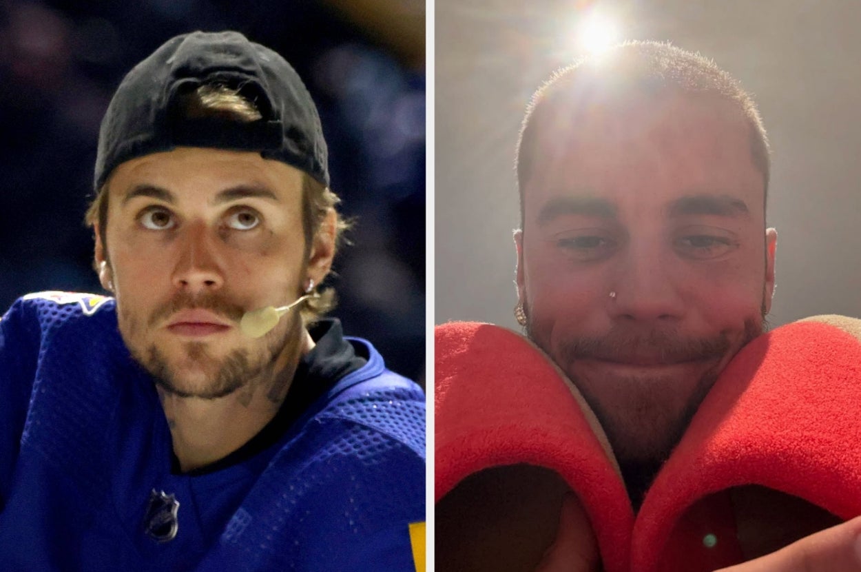 Justin Bieber Commented On An Instagram Post About The Public Concern For His Well-Being, And His Blunt Response Kinda Says It All