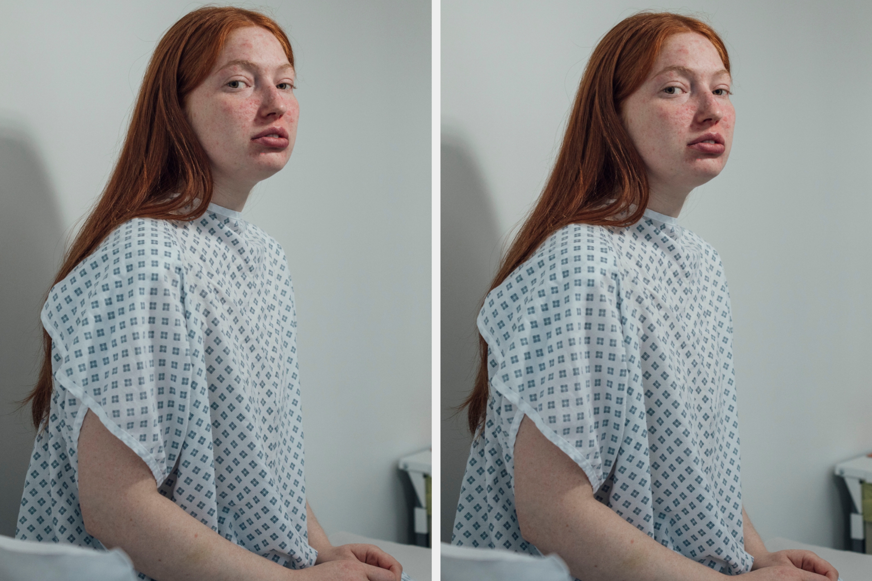 Person with long hair, wearing a hospital gown, sits on a bed. The image appears to be duplicated side by side