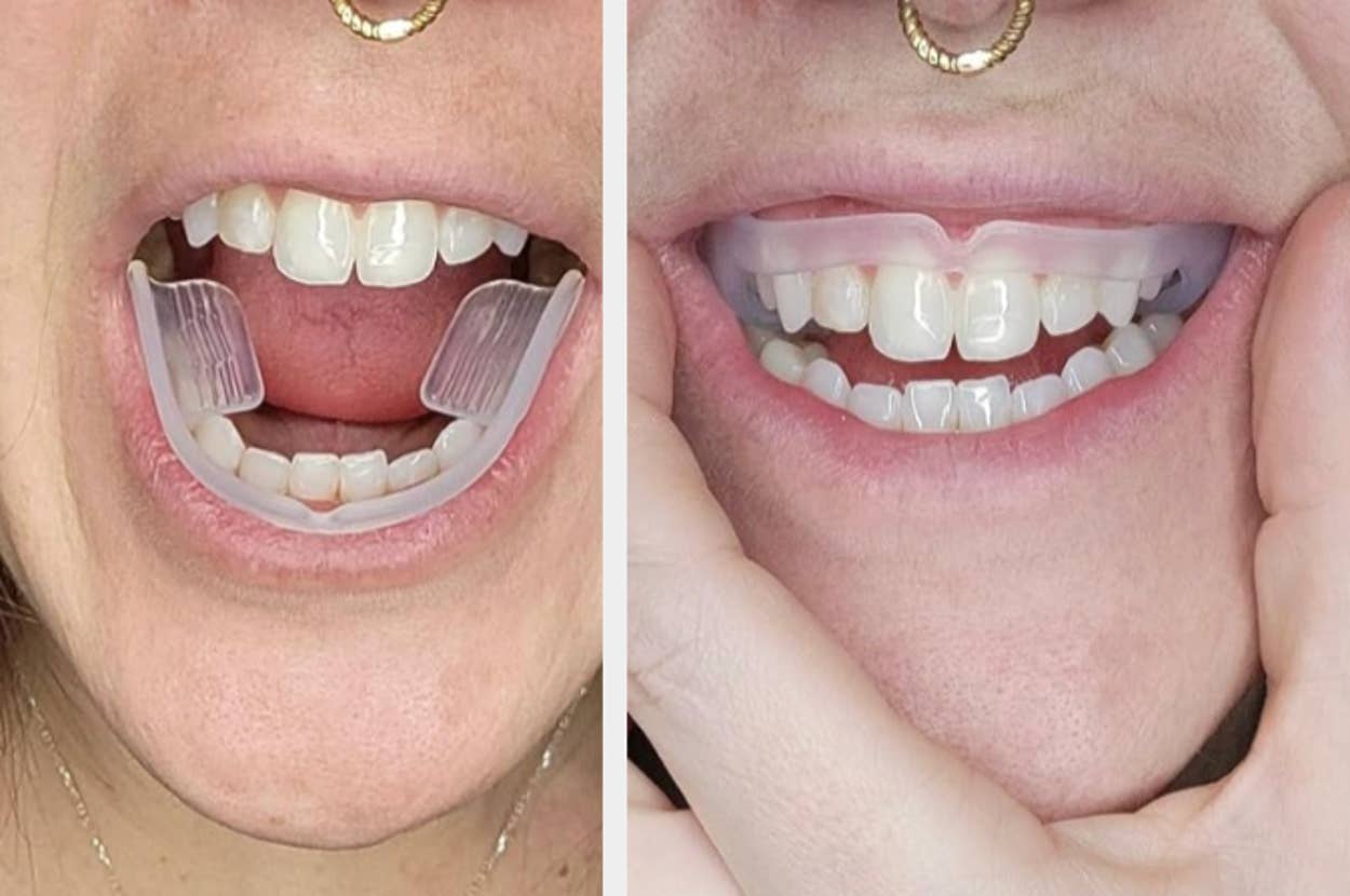 person showing disposable dental guard in mouth