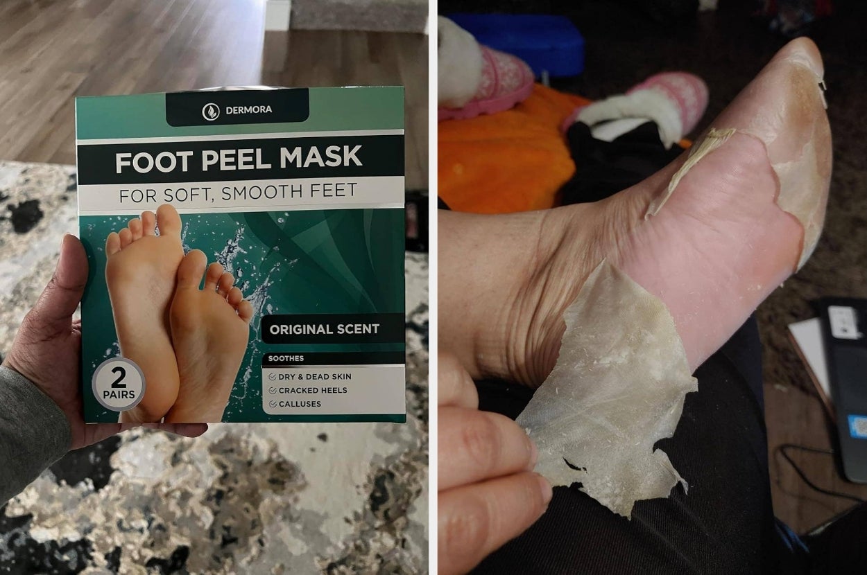 This Foot Peel Mask Gave Reviewers 