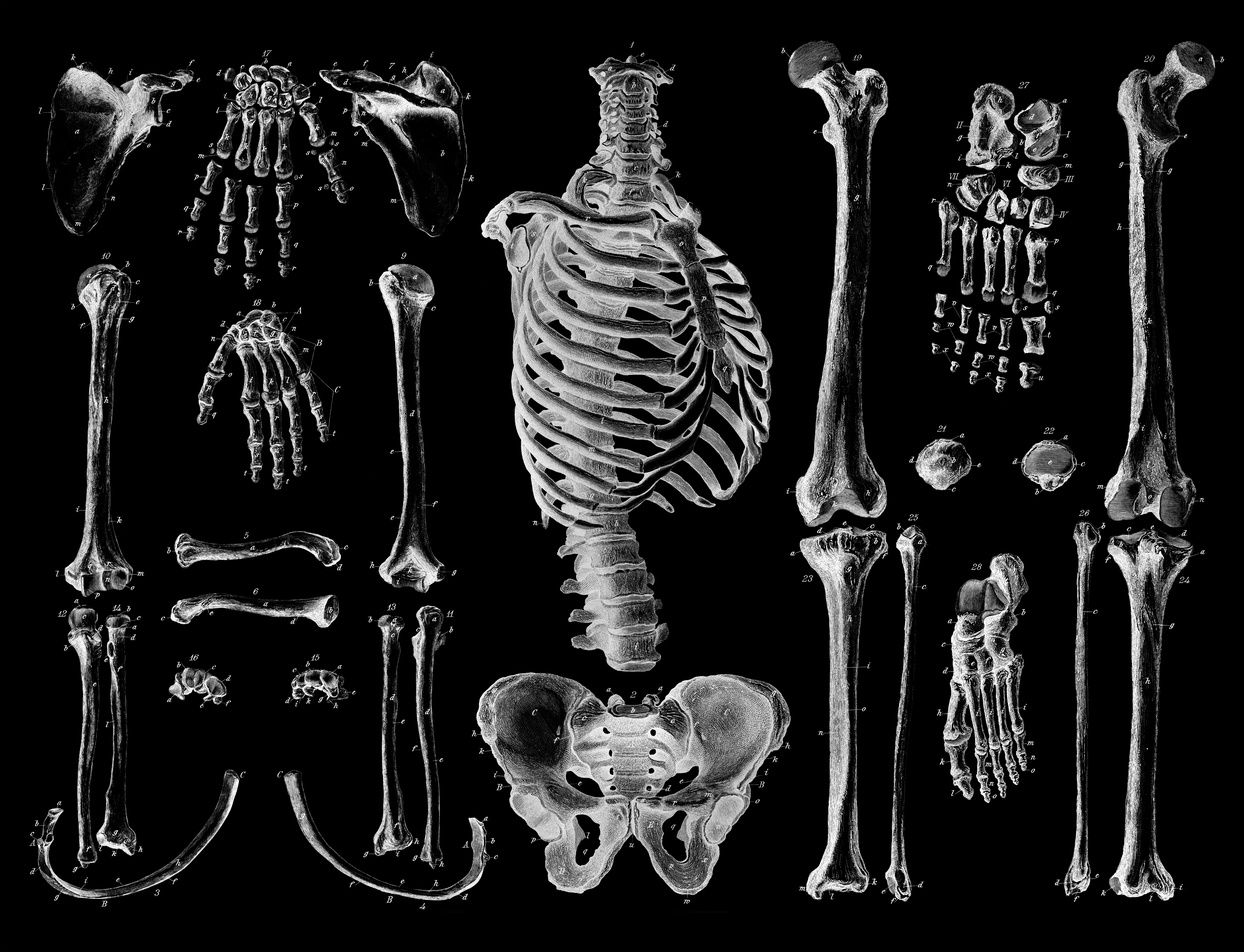X-ray image showing a complete set of human bones arranged separately against a dark background