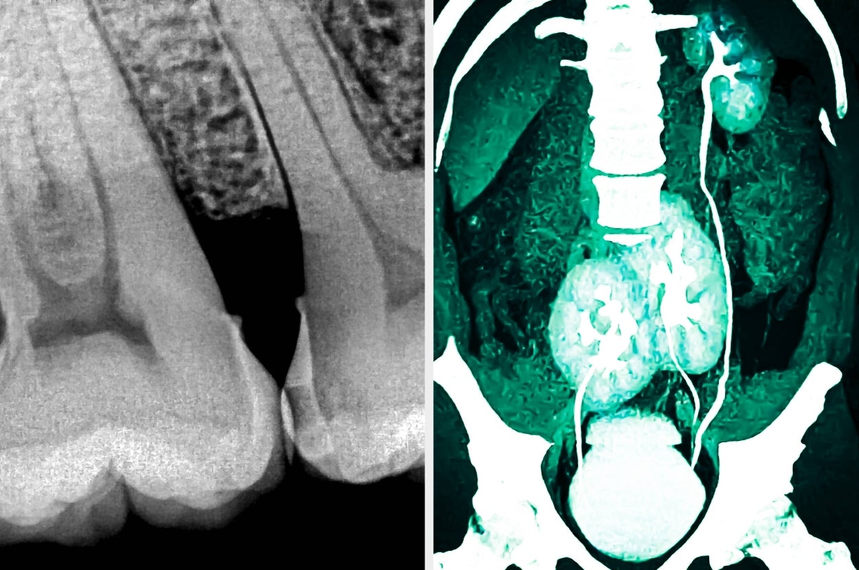 Dental X-ray on the left showing teeth roots; medical scan on the right showing pelvic organs