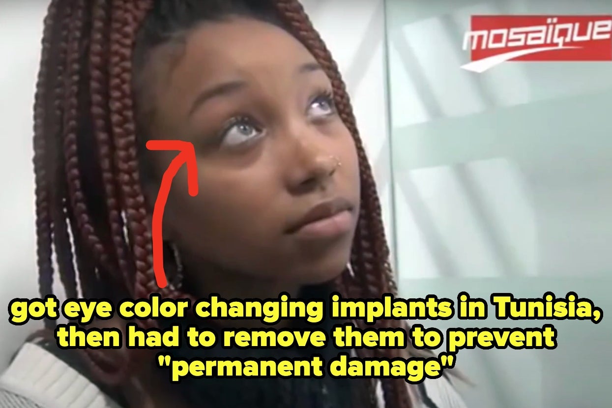 34 Celebrities Who Ditched Their Cosmetic Implants And Went Back To Their Natural Bodies