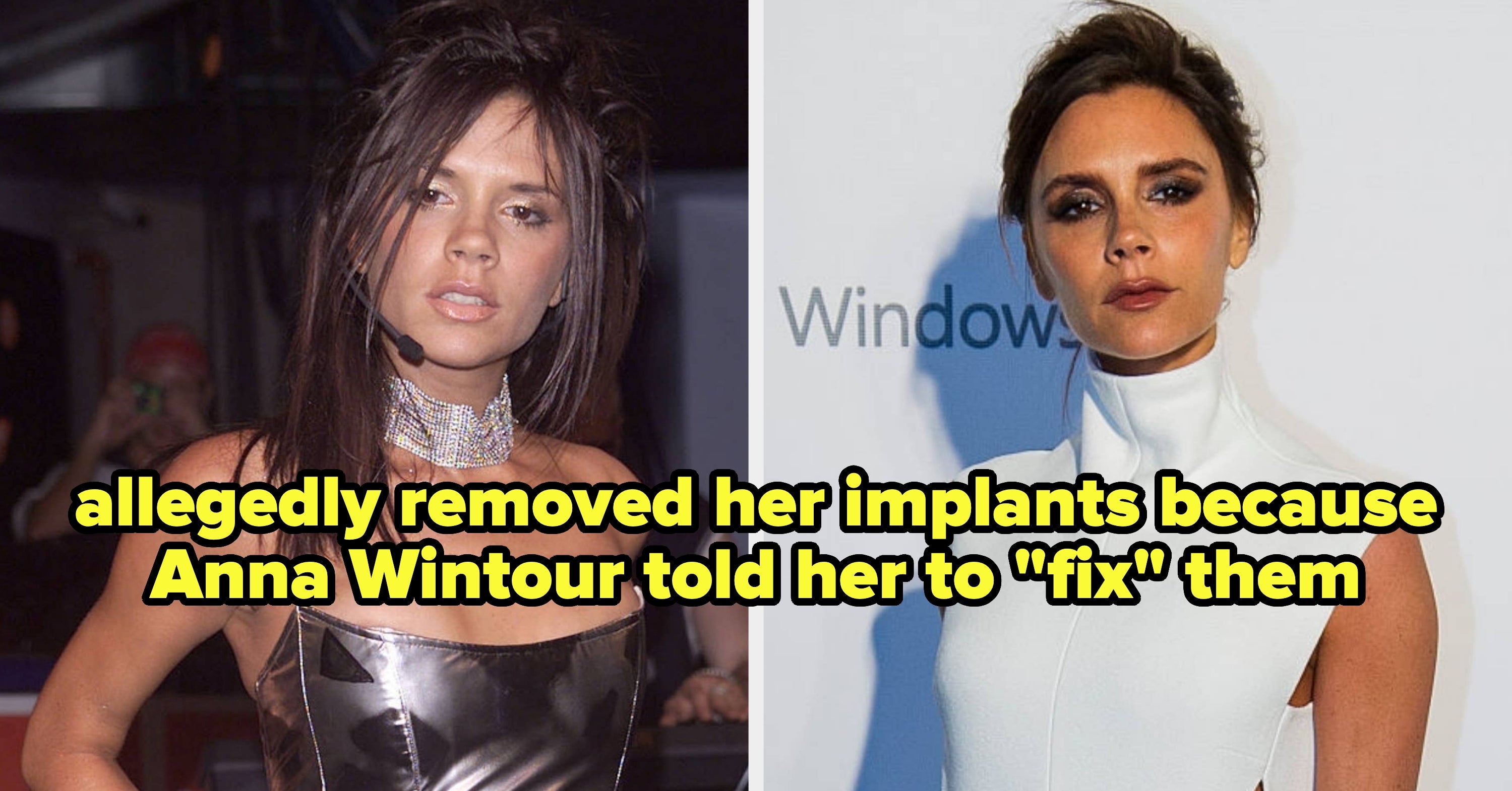 34 Celebs Who Removed Their Breast, Butt, And Eye Implants (And Why)