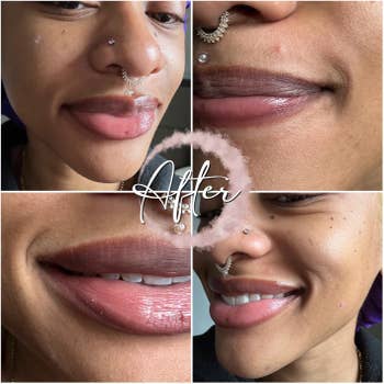 Collage showing a person's lips earlier and aft a cosmetic procedure, highlighting smoother, glossy appearance. The connection