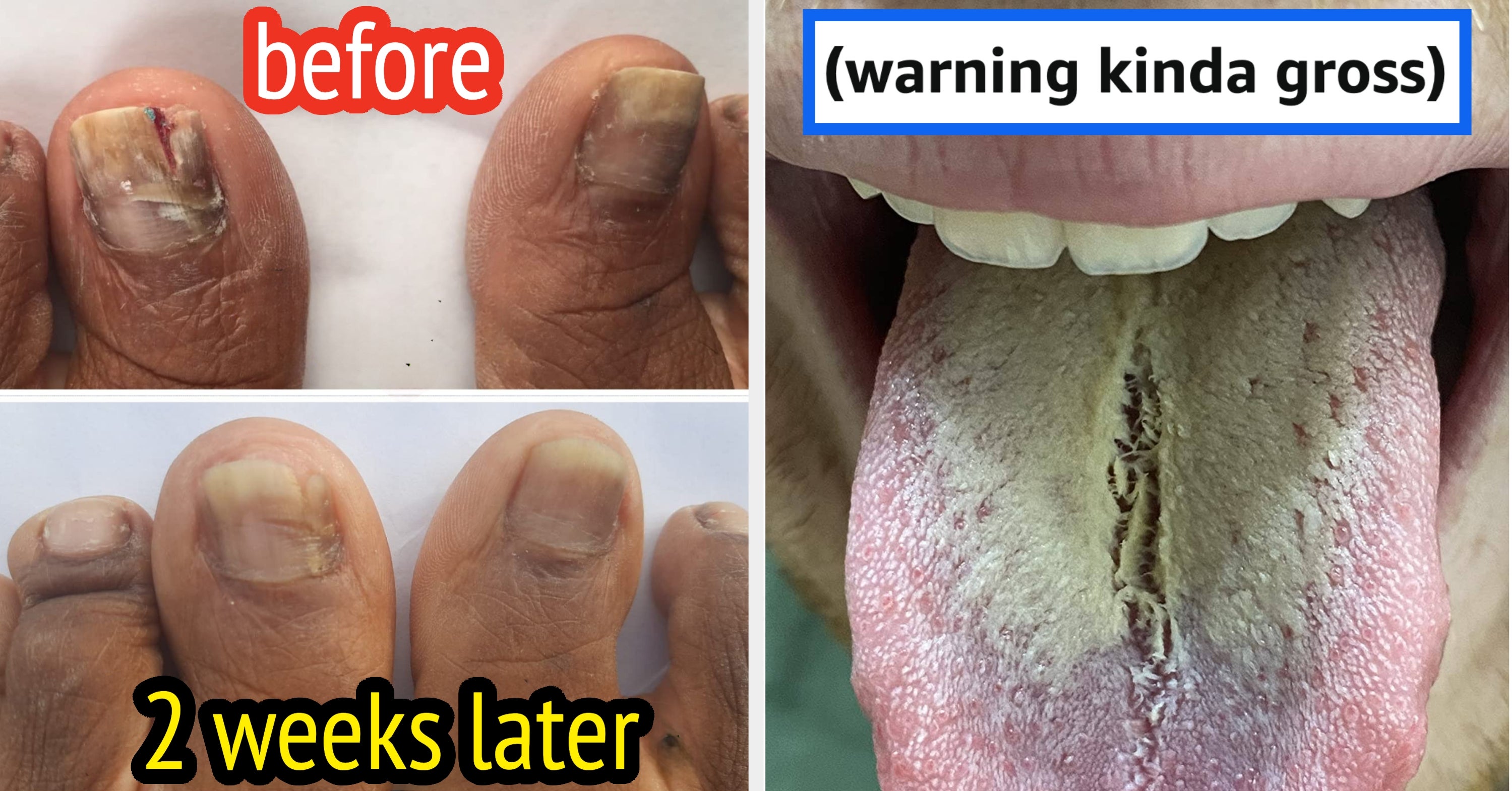 If You Enjoy Pimple Popping Videos, You'll Love The Gross-But-Satisfying Review Photos For These Products