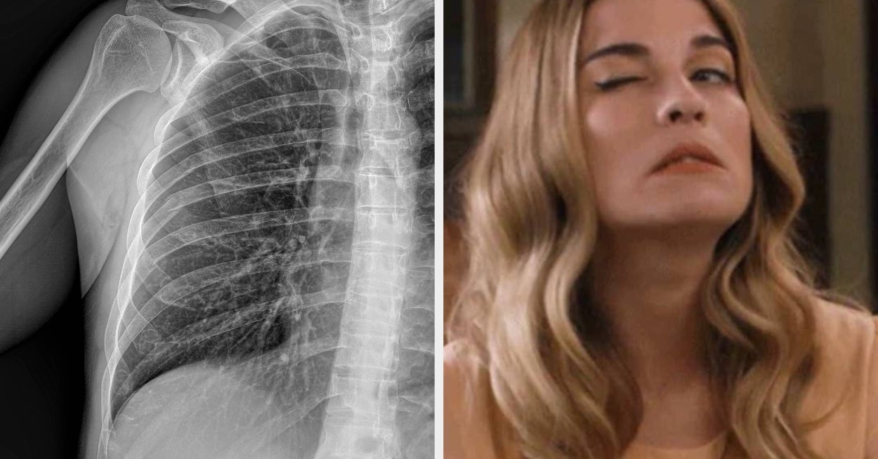 Medical Professionals, I Wanna Know About The Wildest, Rarest Case You've Ever Seen