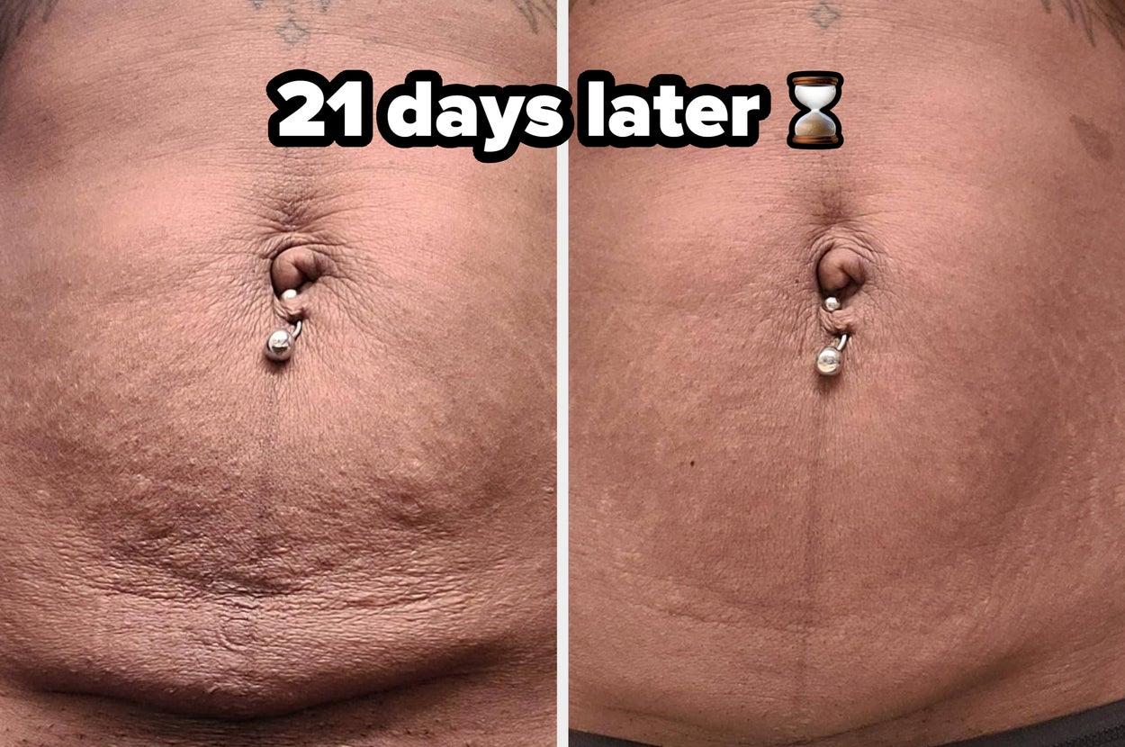 33 Products With Before-And-Afters That’ll Make You Say “No Way” To Your Screen