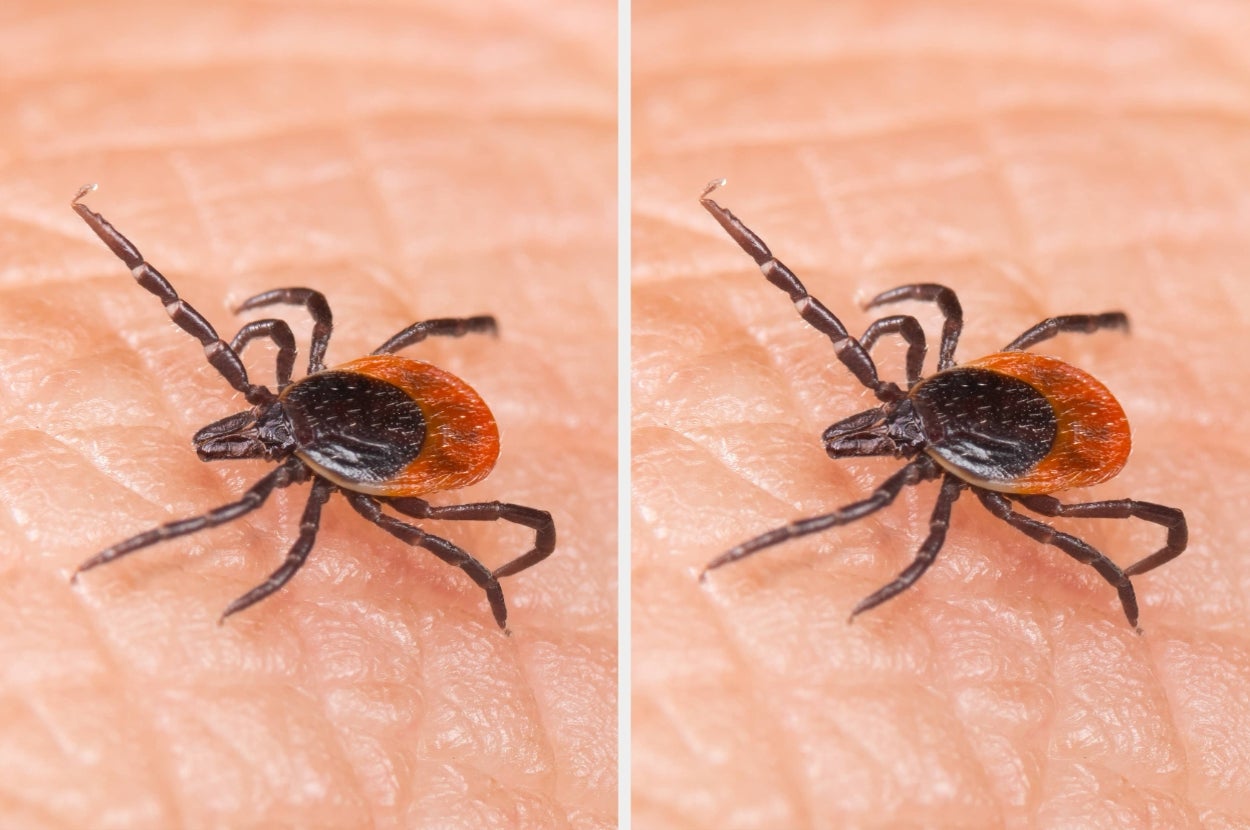 Close-up of a tick on skin, showcasing its intricate details