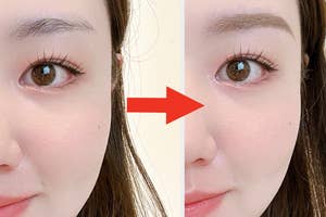 女性の顔のビフォーアフター。アフターの方が肌が滑らかに見える。改善された印象を示す赤い矢印が中央にある。