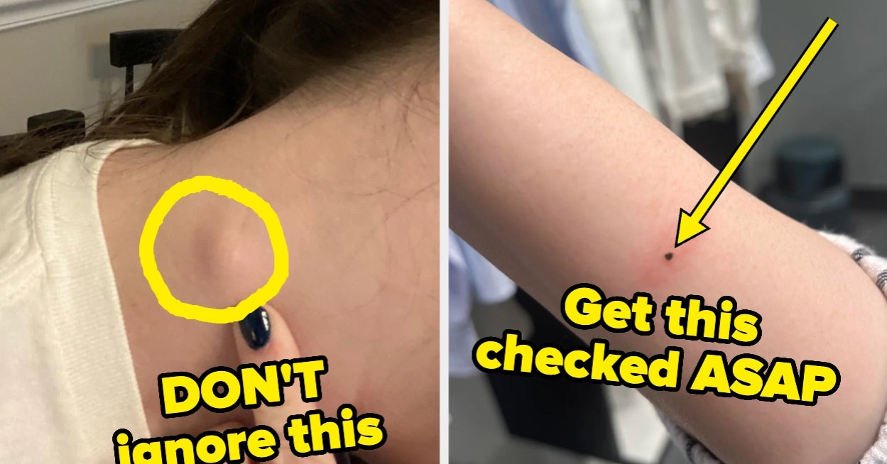 People With Cancer Share Symptoms That Led To Diagnosis