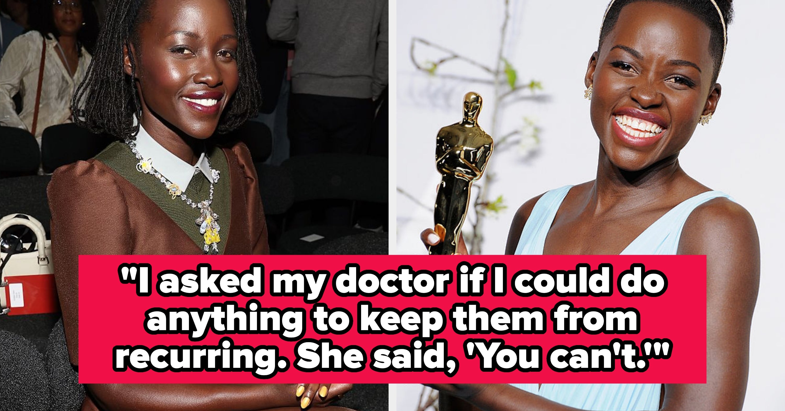 Lupita Nyong'o Got An Unexpected Health Diagnosis The Year She Won An Oscar