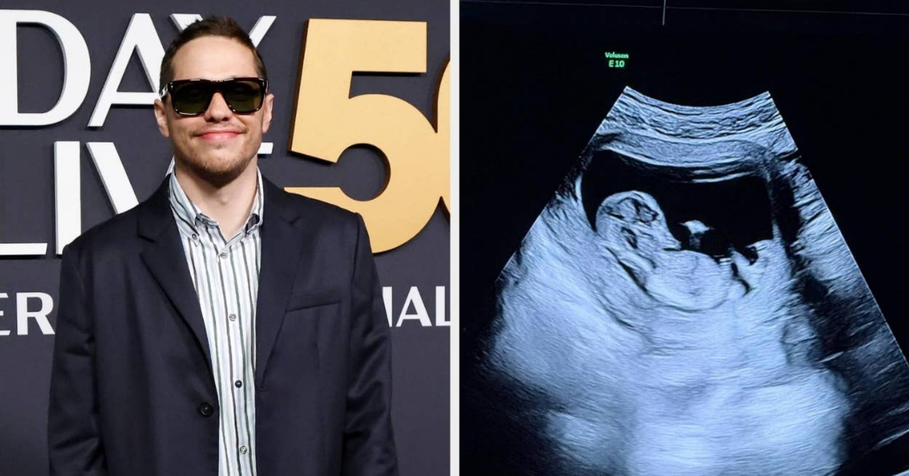 Pete Davidson Is Expecting His First Child With Girlfriend Elsie Hewitt