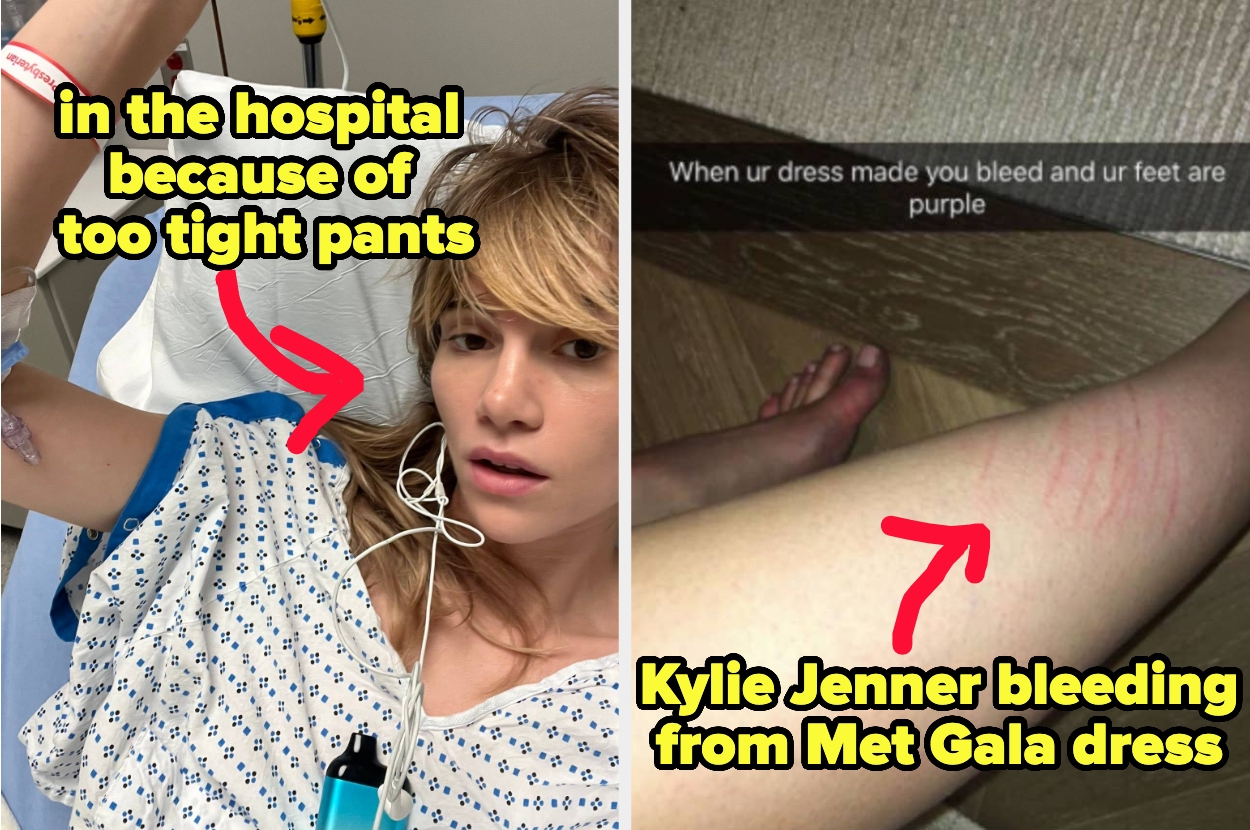 Suki Waterhouse in the hospital because of too tight pants, and Kylie Jenner bleeding from Met Gala dress