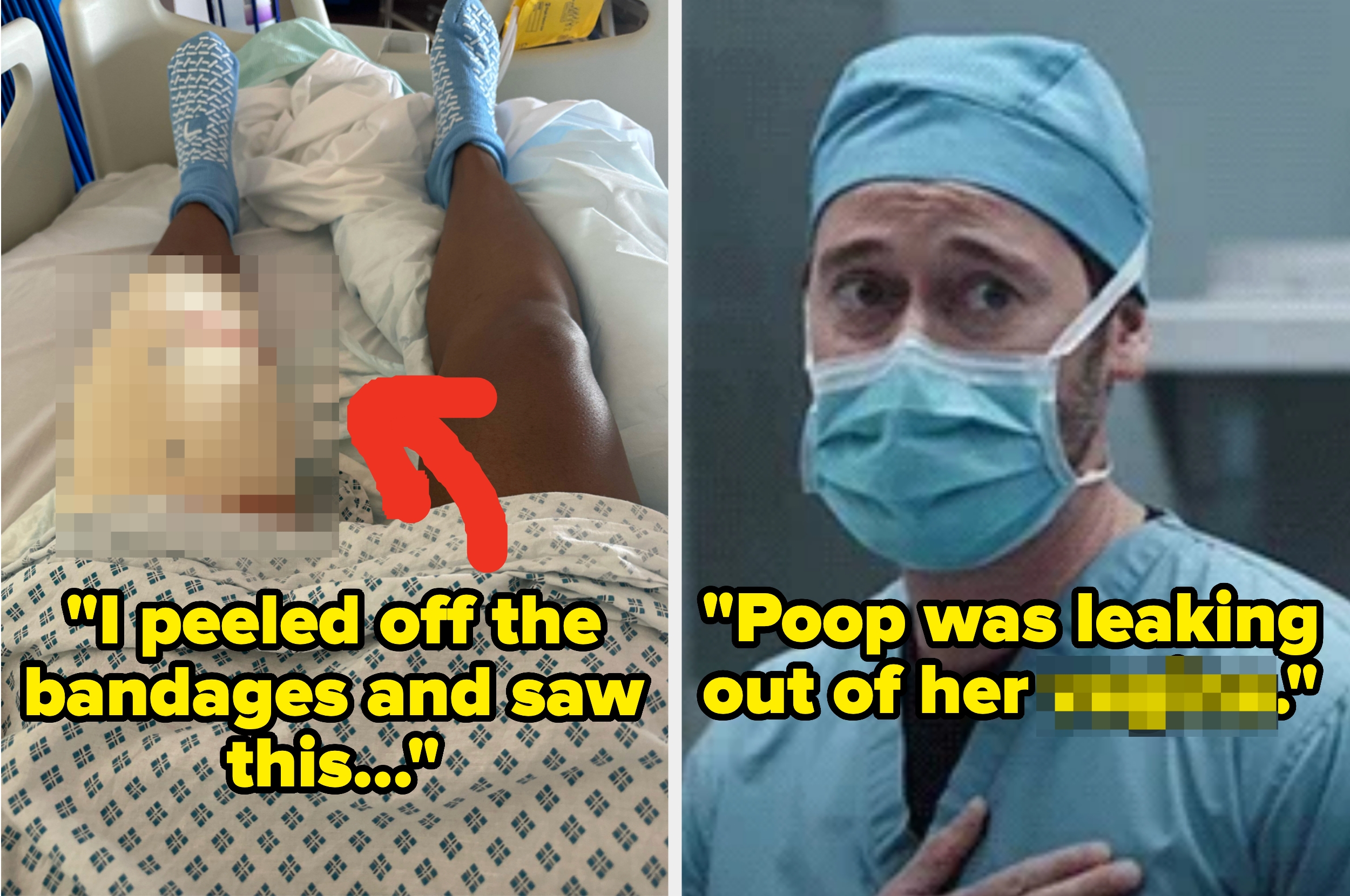 Split image: left shows a leg with blurred bandage area and text: "I peeled off the bandages and saw this"; right shows a surgeon with text: "Poop was leaking out of her"