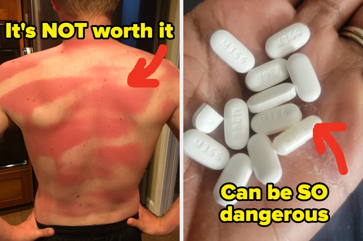 Left: Person with severe sunburn on their back; right: Hand holding white pills; text highlights sun exposure and medication risks
