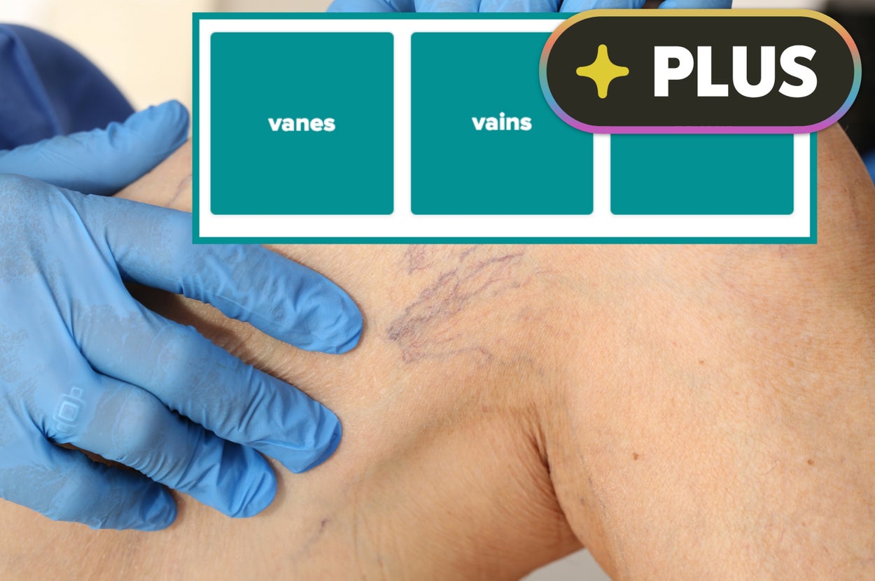 A healthcare professional examines a patient's leg with visible varicose veins. A graphic shows "vanes," "vains," "veins," highlighting "veins."