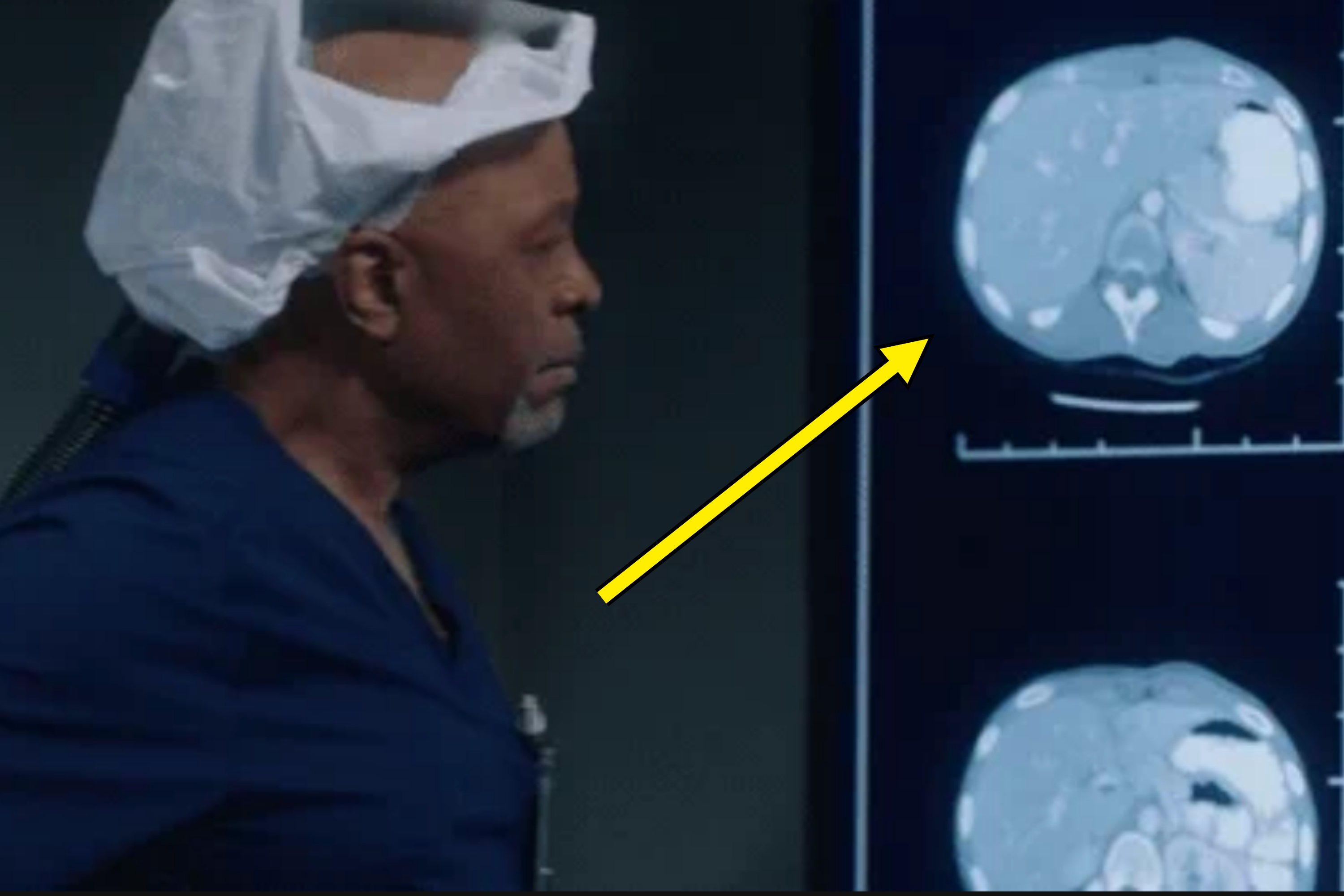 A medical professional in scrubs and a hair cover examines CT scans displayed on a screen