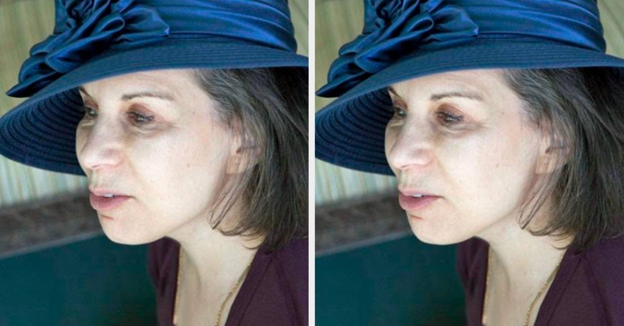 How a Drunk Driver Crash Changed My Identity Forever