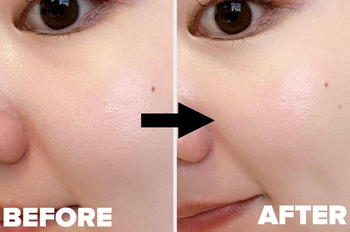 女性の肌の「ビフォー」と「アフター」。アフターでは毛穴が目立たず、つるっとした肌の状態。