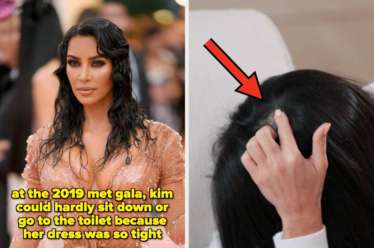 Left: Kim Kardashian at the 2019 Met Gala in a tight dress, with text about how she was hardly able to sit or use the toilet. Right: Arrow pointing at a bald patch