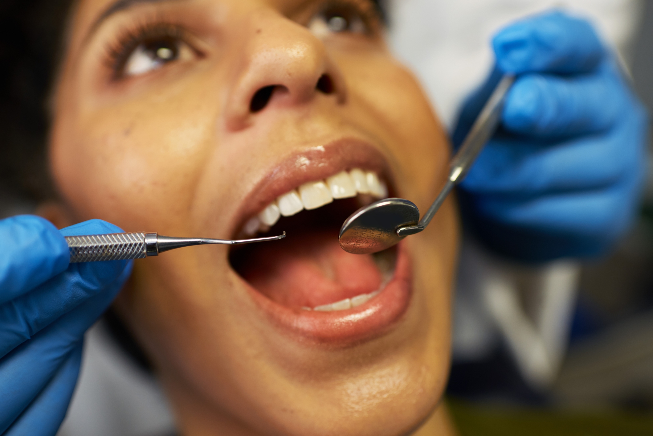 Person hos tannlegen med munn åpen, tannverktøy med sikte og iført blå hansker
