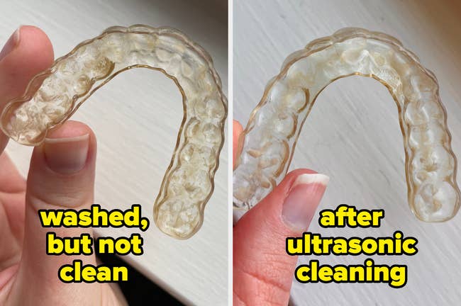 my retainer earlier  cleaning with caked-on grime, and after, astir   wholly  grime-free