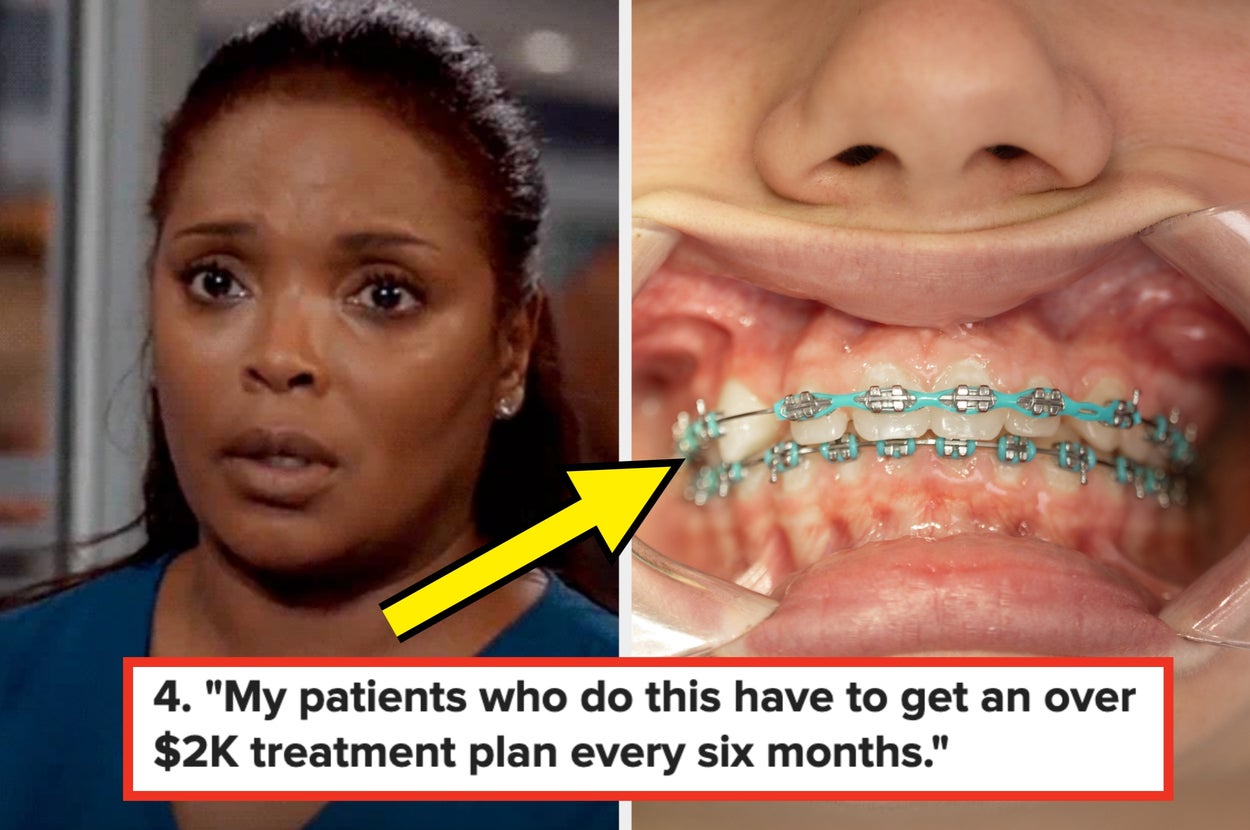 Split image: Left shows a concerned nurse; Right shows a close-up of teeth with braces; caption: "My patients who do this have to get an over $2k treatment plan every six months"