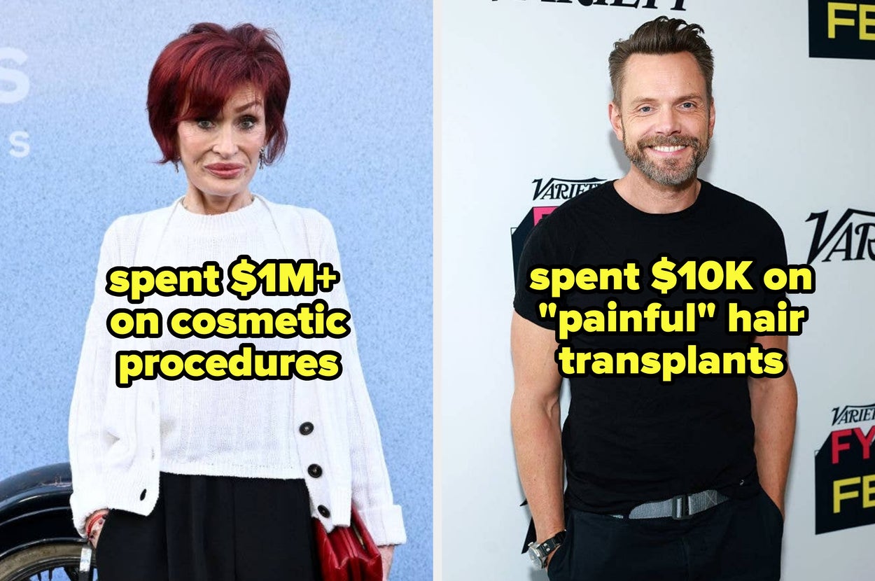 11 Celebs Who Revealed Exactly How Much Money They Spent On Cosmetic Surgery