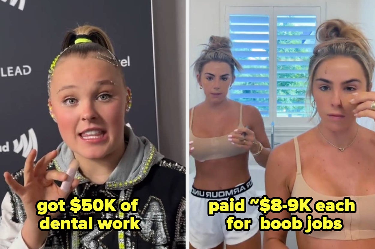 JoJo Siwa got $50K of dental work, and Hanna and Haley CavinderĀ paid about $8-9K each for boob jobs