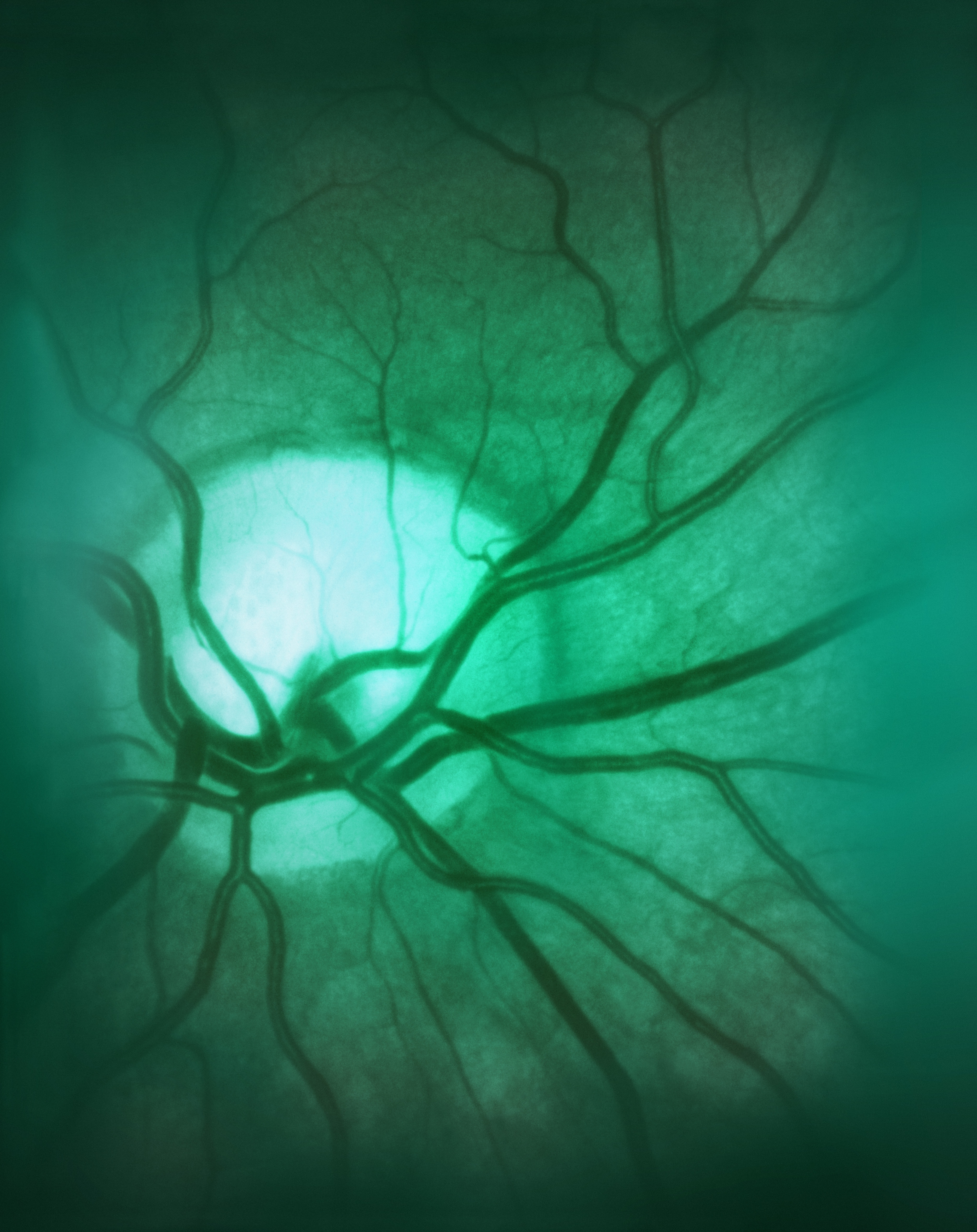 Nærbilde av menneskelige øyne som viser frem intrikate blodkar under en levende lyskilde, som ligner et kunstnerisk abstrakt mønster