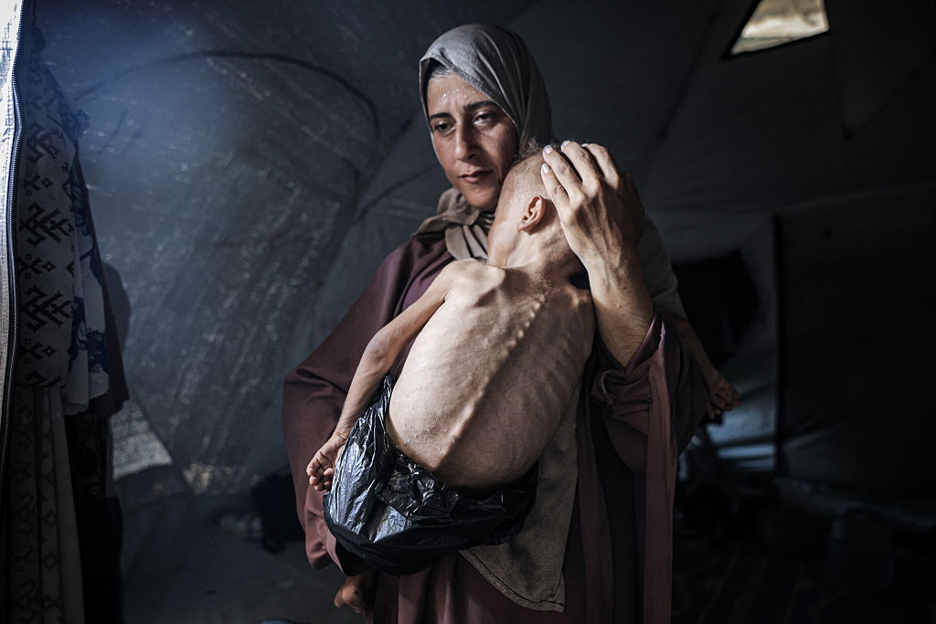 A concerned person cradles a malnourished child in a tent, highlighting humanitarian needs