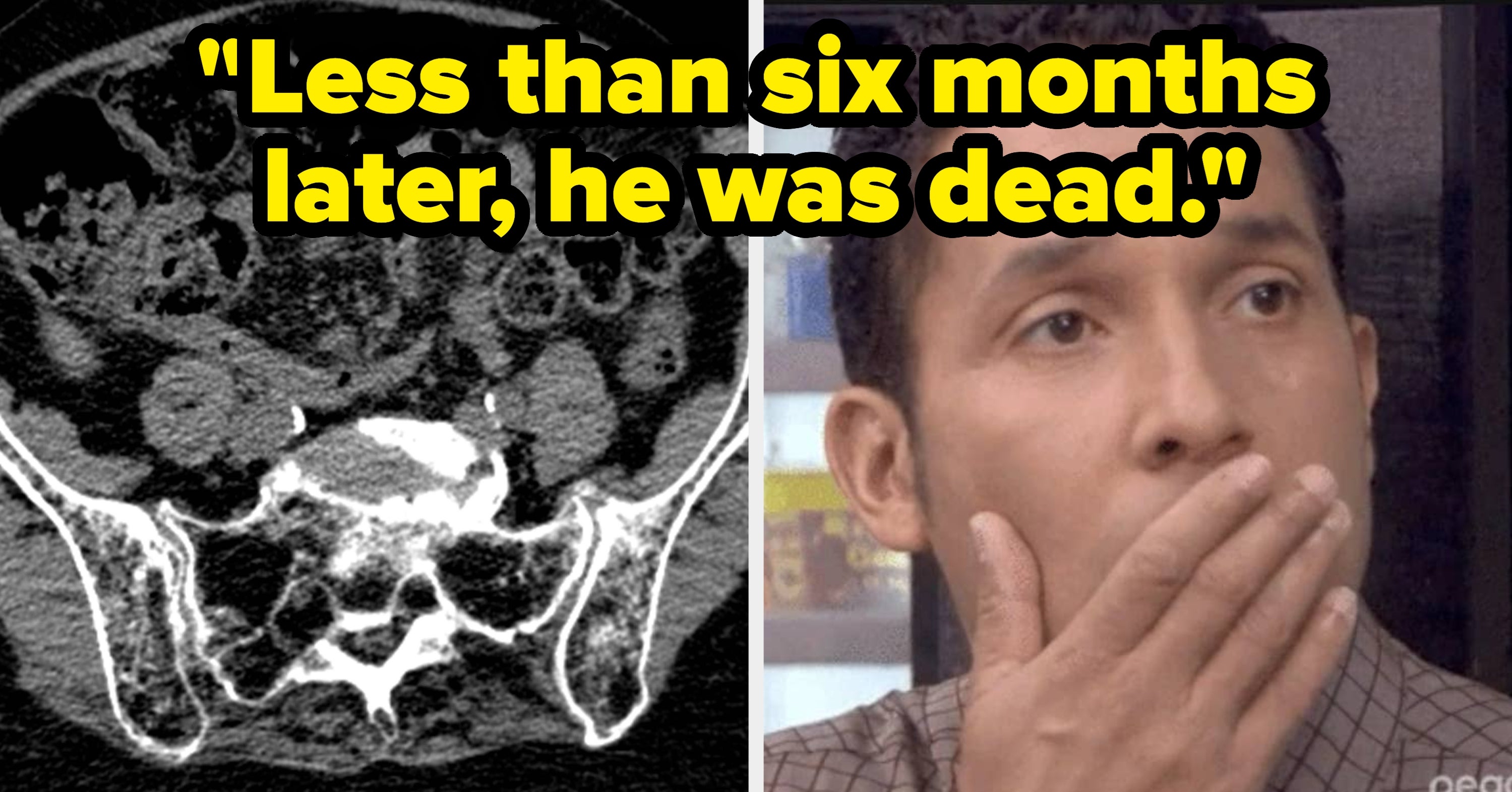 Doctors And Patients Are Sharing The “Mild” Symptoms That Actually Could Be A Sign Of Something Very, Very Major