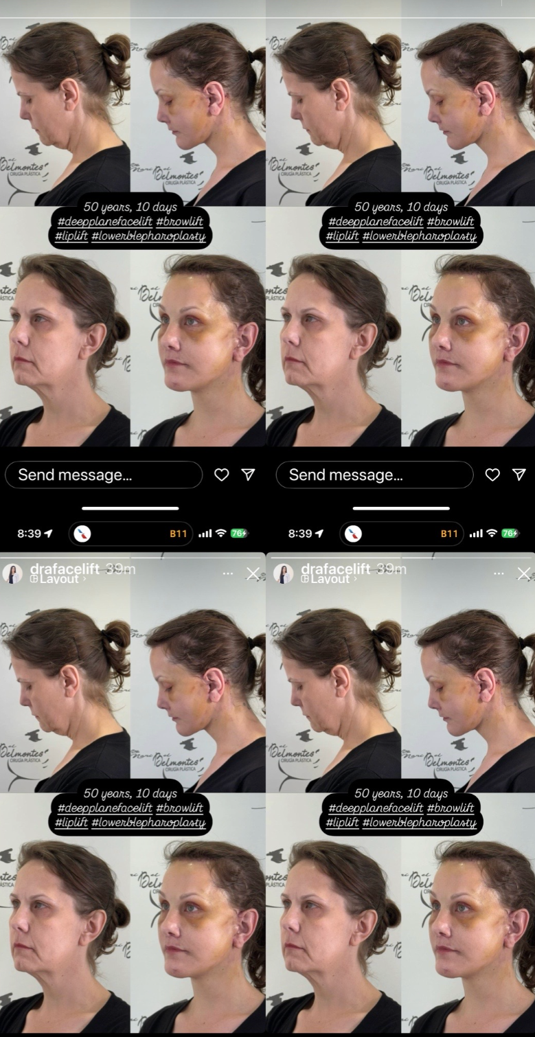 Collage showing a woman's face at different angles and times, with text suggesting a 10-day skincare transformation