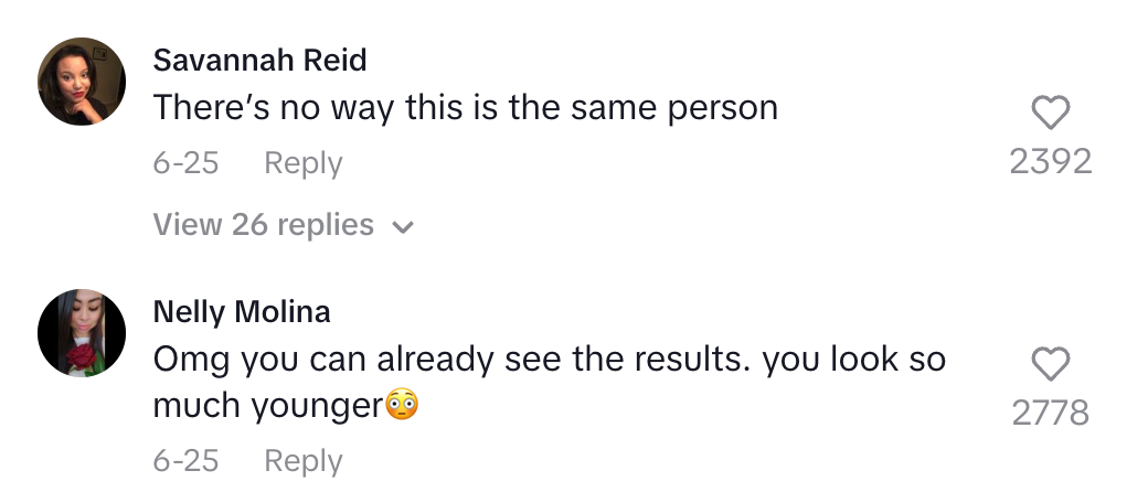Social media comments compliment a person's youthful appearance, expressing disbelief in their transformation