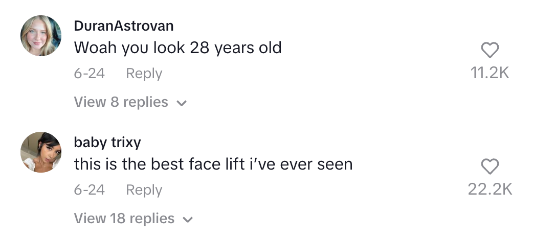 Social media comments about someone's youthful appearance and facelift, each with thousands of likes and many replies