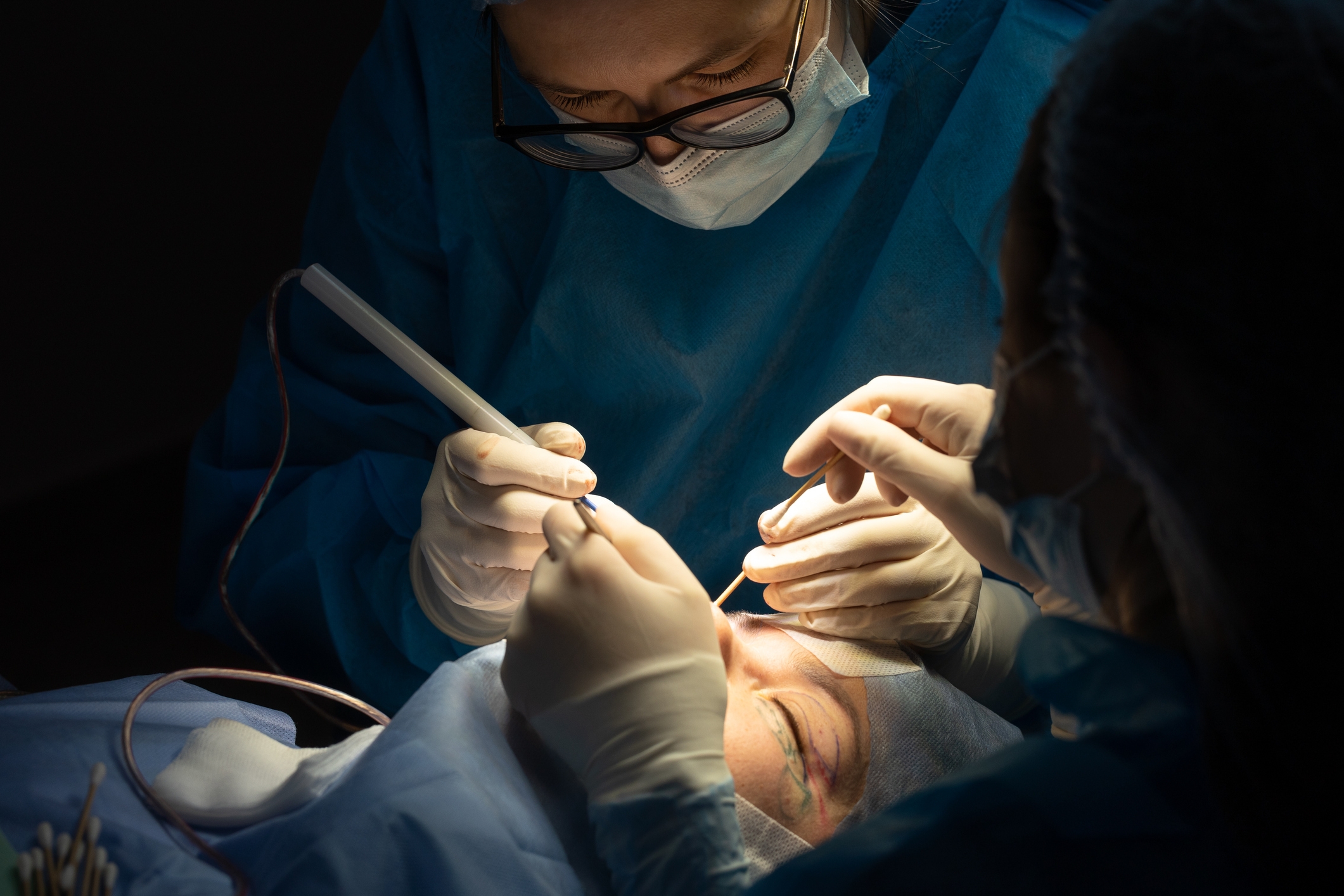 Kirurger fokuserte på å utføre en delikat øyeoperasjon, ved å bruke spesialiserte instrumenter under kirurgiske lys
