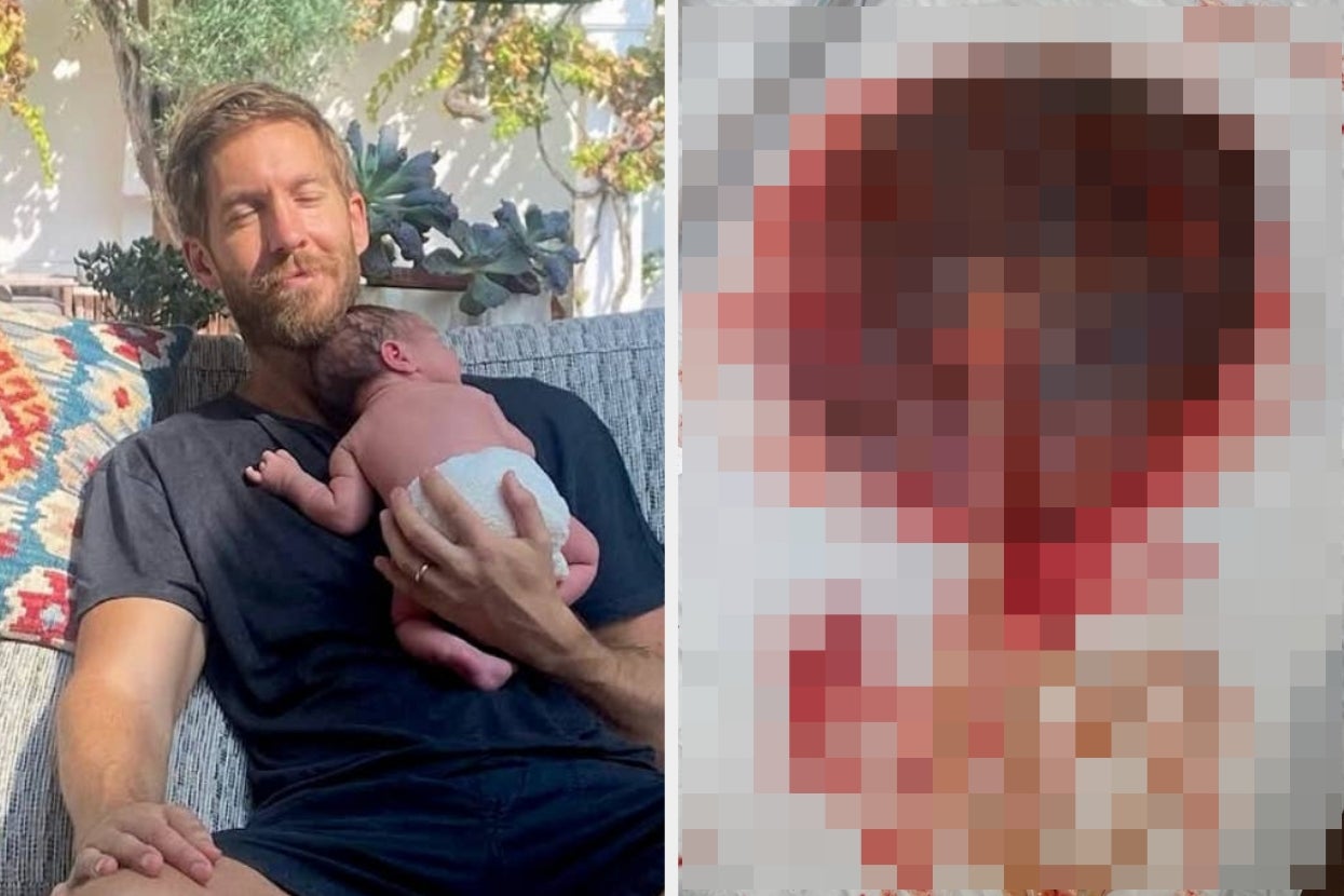 Left: Calvin Harris holding a baby on a sofa outdoors, smiling gently. Right: Blurred photo of a placenta