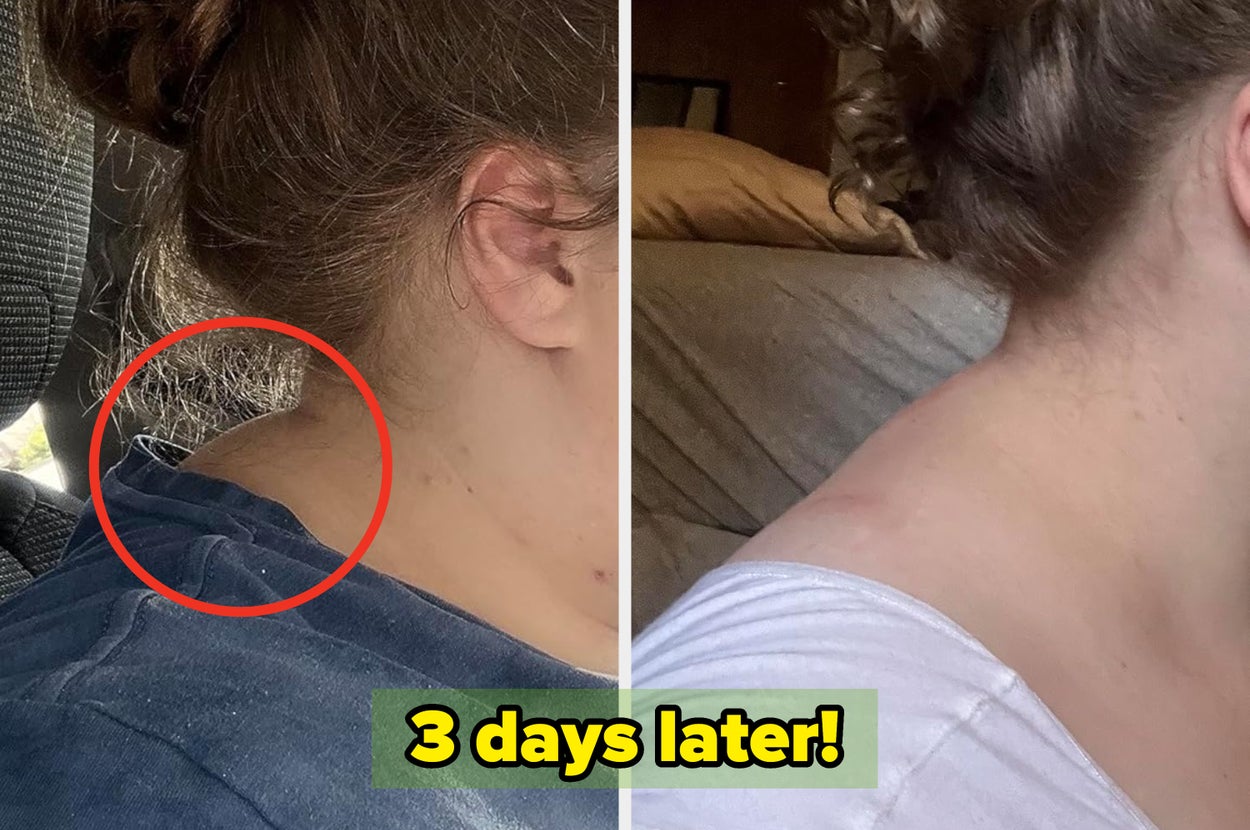 If You Struggle Solving Those Somewhat Obnoxious Personal Care Problems, These 58 Items Will Help You Out