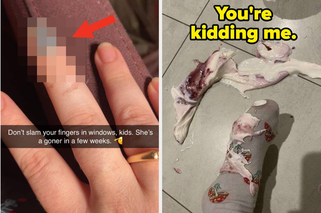 Left: Pixelated injured finger with text warning about slamming windows. Right: Foot in sock steps in spilled yogurt with berries