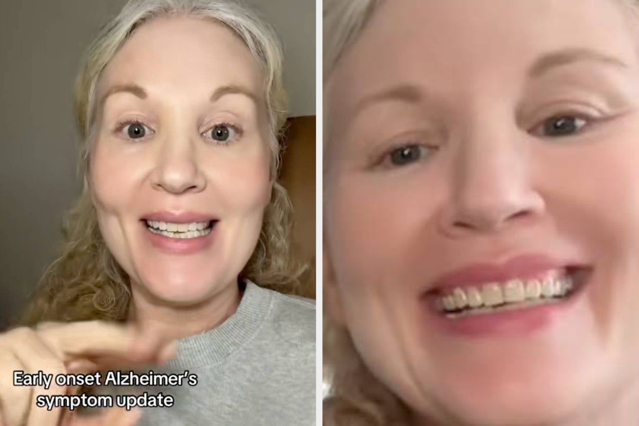 Two close-up images of a person smiling. Text: "Early onset Alzheimer's symptom update."