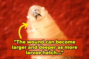Close-up of a fly larvae on skin with text: "The wound can become larger and deeper as more larvae hatch..."