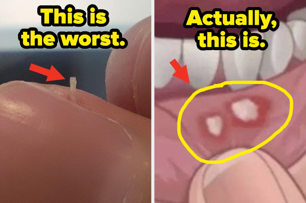 Close-up images compare a tiny skin hangnail on a finger and a painful sore inside a mouth, suggesting which is worse