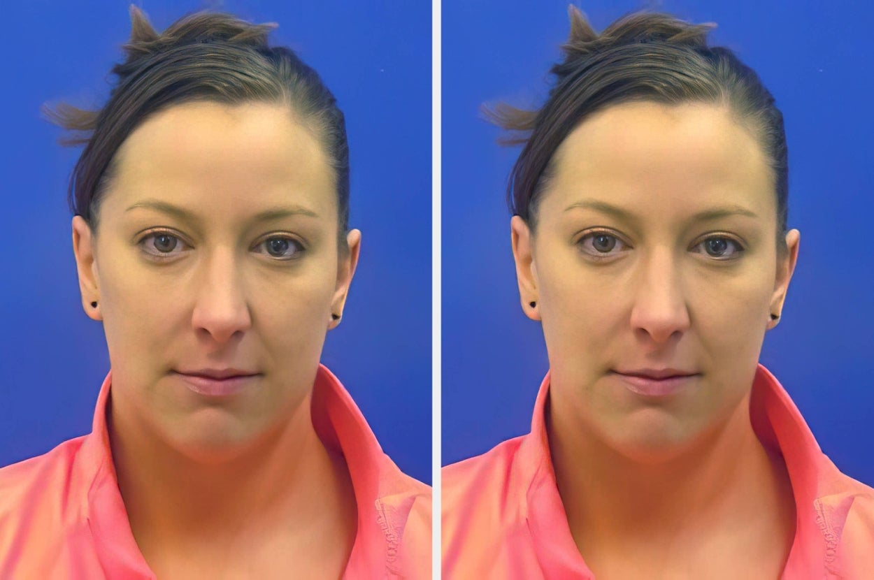 Two side-by-side identical portraits of a person with short hair wearing a collared shirt, looking directly at the camera