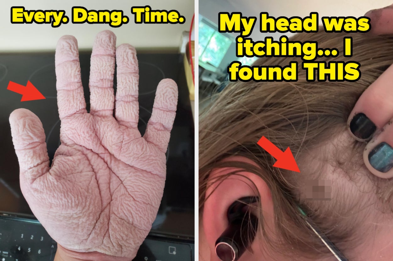 Left: Pruney hand with a red arrow pointing. Right: Person shows bug behind ear with red arrow pointing. Text explains relatable experiences