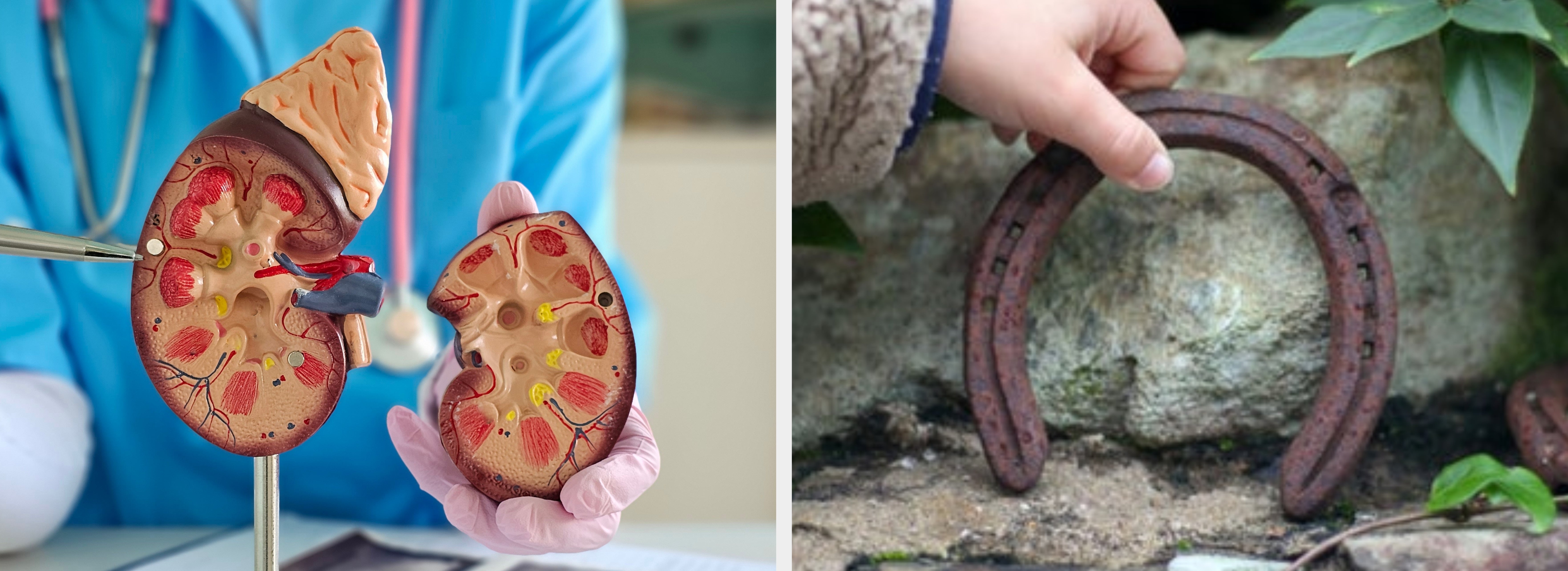 Modell av en menneskelig nyre holdt av en person som har på seg medisinske hansker og et stetoskop, med utklippstavle i bakgrunnen