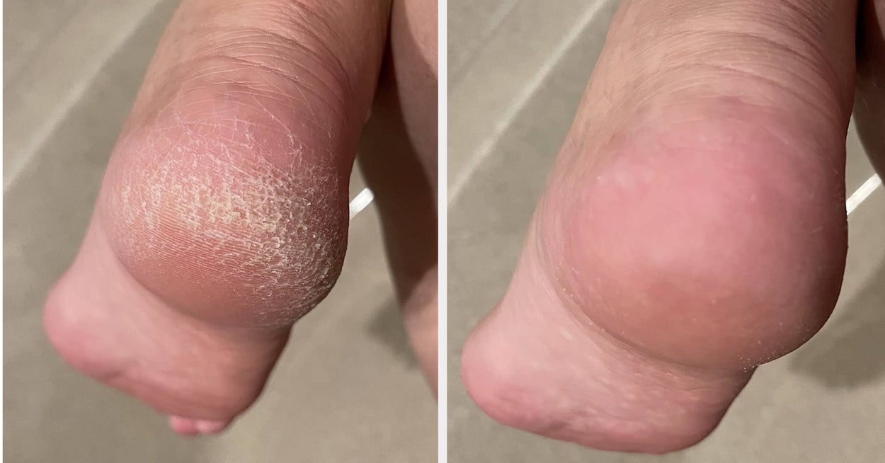 32 Products With Before-And-After Photos That'll Inspire You To Get Your Life Together